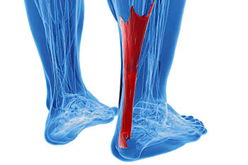 Achilles tendon treatment in the Los Angeles County, CA: Los Angeles, Beverly Hills, Culver City, Santa Monica, Marina Del Rey, Inglewood, Thousand Oaks, Burbank, Glendale, Pasadena, Malibu areas