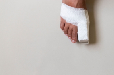 A Broken Toe May Be More Than a Minor Injury