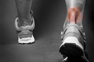 Repairing an Achilles Tendon Injury